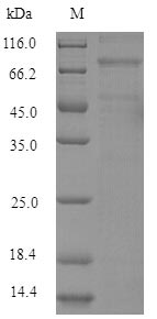 Recombinant Mouse Lysyl oxidase homolog 4(Loxl4)