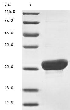 Recombinant Mouse Major urinary protein 11(Mup11)
