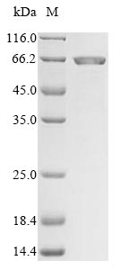 Recombinant Mouse Matrix metalloproteinase-24(Mmp24),partial