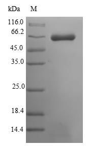 Recombinant Mouse Muscle, skeletal receptor tyrosine-protein kinase(Musk),partial