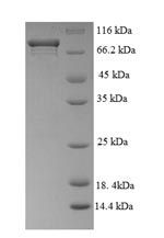 Recombinant Mouse Myc proto-oncogene protein(Myc)