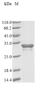 Recombinant Mouse Myocilin(Myoc),partial