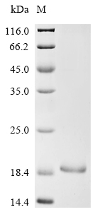 Recombinant Mouse Neuron navigator 3(Nav3),partial