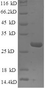 Recombinant Mouse Nidogen-1(Nid1),partial