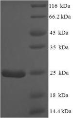Recombinant Mouse Normal mucosa of esophagus-specific gene 1 protein(Nmes1)