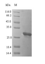 Recombinant Mouse Oncomodulin(Ocm)