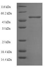 Recombinant Mouse Ornithine carbamoyltransferase, mitochondrial(Otc)