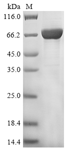 Recombinant Mouse Peroxisomal acyl-coenzyme A oxidase 1(Acox1)