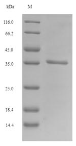 Recombinant Mouse Placenta-expressed transcript 1 protein(Plet1)