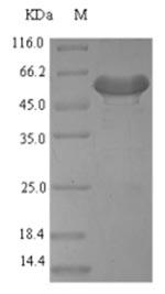 Recombinant Mouse Platelet-derived growth factor D(Pdgfd)