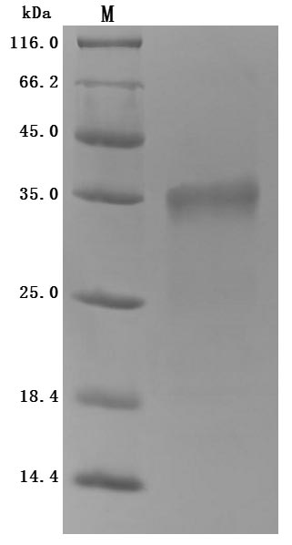 Recombinant Mouse Prolactin receptor(Prlr),partial (Active)