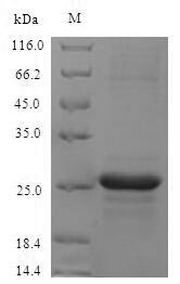 Recombinant Mouse Protein S100-A8(S100a8)