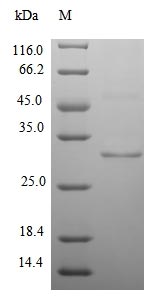 Recombinant Mouse [Pyruvate dehydrogenase [lipoamide]] kinase isozyme 3, mitochondrial (Pdk3),partial