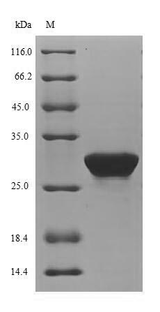 Recombinant Mouse [Pyruvate dehydrogenase [lipoamide]] kinase isozyme 4,mitochondrial(Pdk4),partial