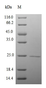 Recombinant Mouse RNA polymerase II subunit A C-terminal domain phosphatase(Ctdp1),partial