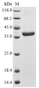 Recombinant Mouse Receptor-type tyrosine-protein phosphatase S(Ptprs),partial