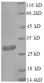 Recombinant Mouse Scavenger receptor cysteine-rich type 1 protein M130(Cd163) ,partial