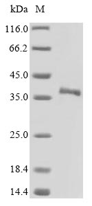 Recombinant Mouse Secreted frizzled-related protein 5(Sfrp5)