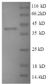 Recombinant Mouse Thrombospondin-1(Thbs1)，partial