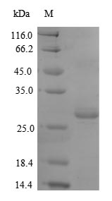 Recombinant Mouse Thrombospondin-2(Thbs2),partial