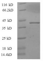 Recombinant Mouse Thrombospondin-3(Thbs3),partial