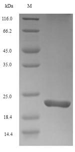 Recombinant Mouse Triggering receptor expressed on myeloid cells 2(Trem2),partial