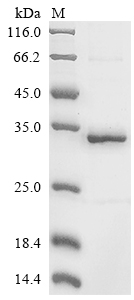 Recombinant Mouse Tripeptidyl-peptidase 2(Tpp2),partial