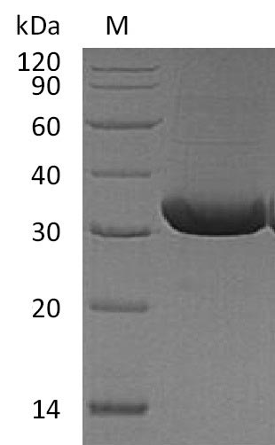 Recombinant Mouse Tumor necrosis factor ligand superfamily member 11(Tnfsf11),partial (Active)