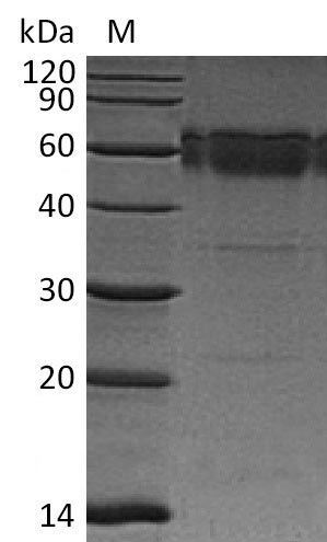 Recombinant Mouse Tumor necrosis factor receptor superfamily member 10B(Tnfrsf10b),partial (Active)