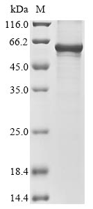 Recombinant Mouse Wilms tumor protein homolog(Wt1)