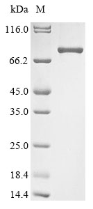 Recombinant Mouse Zinc finger protein Helios(Ikzf2)