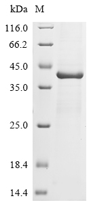 Recombinant Murine polyomavirus Major capsid protein VP1