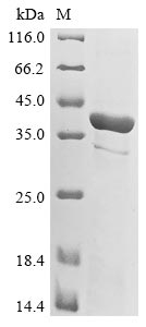 Recombinant Murine polyomavirus Minor capsid protein VP2