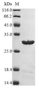 Recombinant Mycobacterium tuberculosis Cell division protein FtsQ(ftsQ),partial
