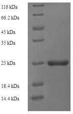 Recombinant Mycobacterium tuberculosis ESAT-6-like protein EsxH(esxH),partial