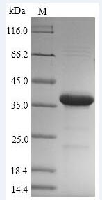Recombinant Mycobacterium tuberculosis Hypoxic response protein 1(hrp1)