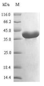 Recombinant Mycoplasma pneumoniae Methionine aminopeptidase(map)