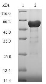 Recombinant Neisseria meningitidis serogroup B / serotype 15 Major outer membrane protein P.IB(porB) 