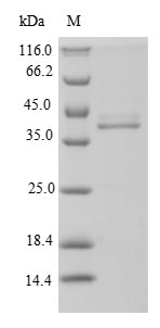 Recombinant Neisseria meningitidis serogroup B Penicillin-binding protein 1A(mrcA),partial