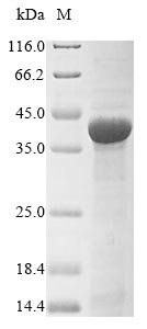Recombinant Neisseria meningitidis serogroup B Transferrin-binding protein 1(tbp1),partial