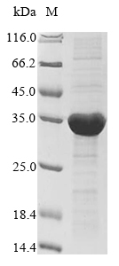 Recombinant Nostoc sp. All1616 protein(all1616)