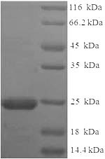 Recombinant Onchocerca volvulus OV-16 antigen(OV16)