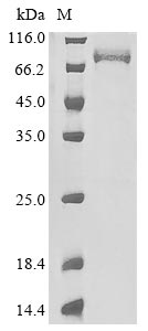 Recombinant Paeniclostridium sordellii Sialidase