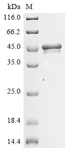 Recombinant Paeniclostridium sordellii Sialidase