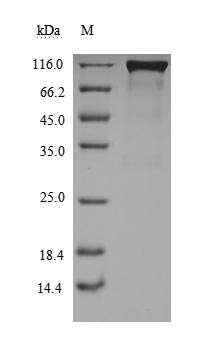 Recombinant Paguma larvata Angiotensin-converting enzyme 2(ACE2),partial (Active)