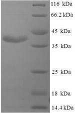 Recombinant Pig Prolactin(PRL)