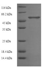 Recombinant Plasmodium falciparum Multidrug resistance protein(MDR1),partial