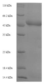 Recombinant Plasmodium falciparum Plasmepsin-1(PF14_0076)