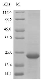 Recombinant Pongo abelii Transmembrane protein 168(TMEM168),partial