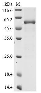 Recombinant Porphyromonas gingivalis Gingipain R2(rgpB)